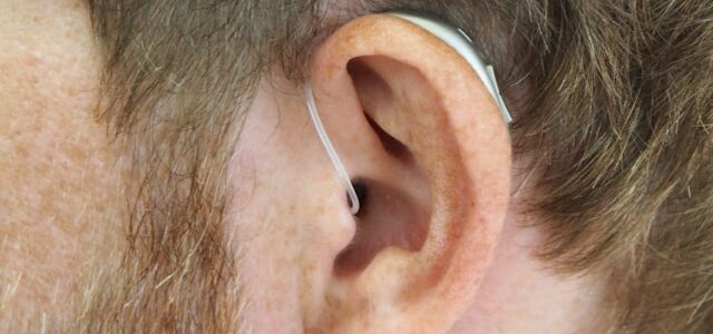Alles über den Phonak ComPilot II